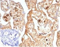 alpha-Fetoprotein/AFP Rabbit anti-Human, Clone: AFP/7007R, Novus Biologicals:Antibodies:Primary